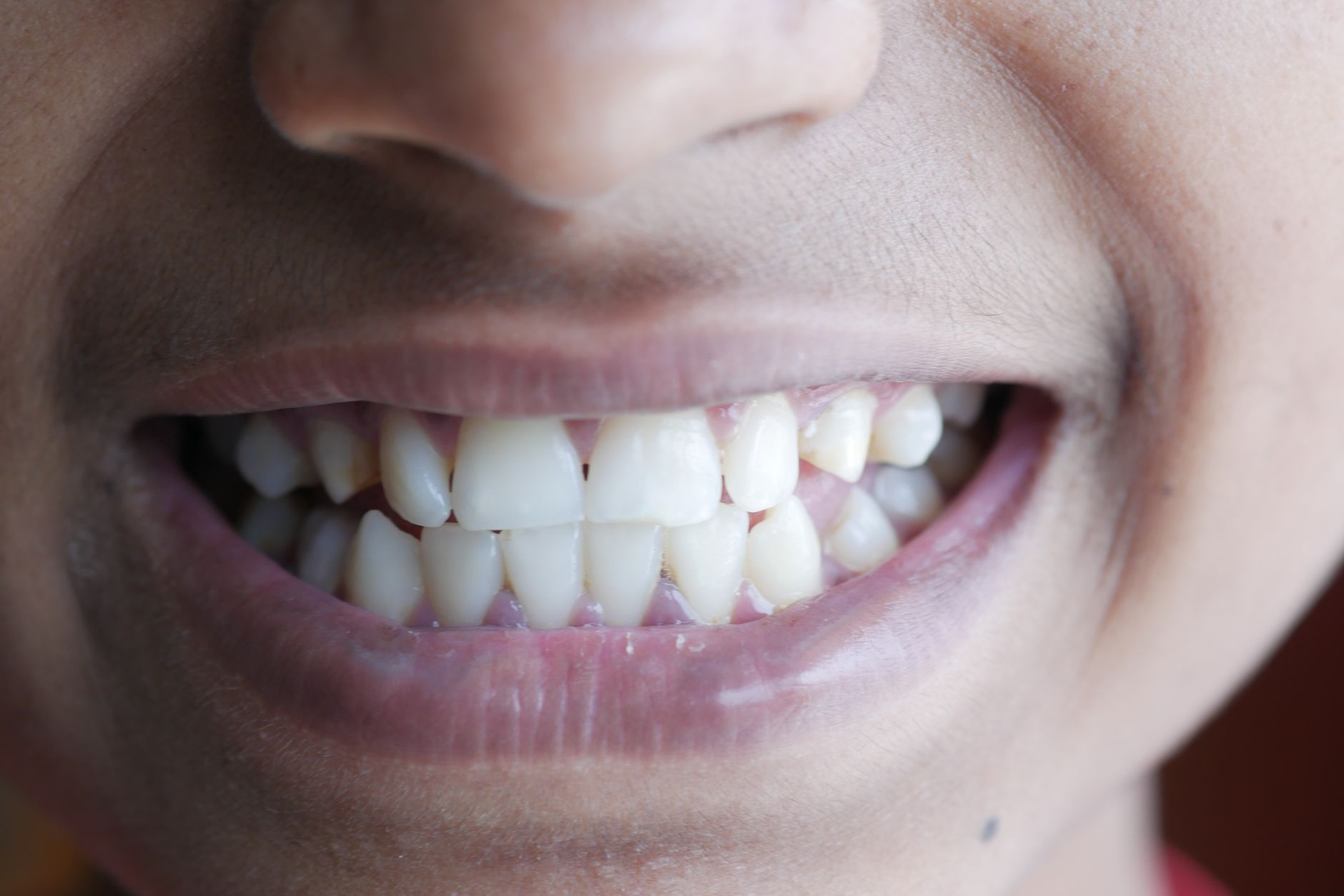 Bright healthy smile after using a good electric toothbrush