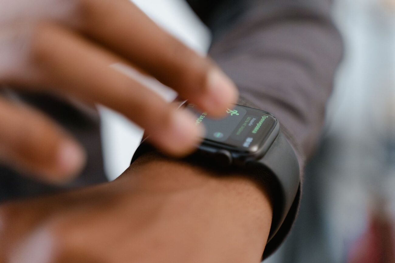 How to Fix a Smartwatch Rash and Prevent Wrist Discomfort 1 Close up of wrist redness caused by a smartwatch rash