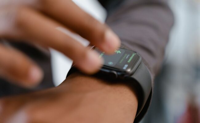How to Fix a Smartwatch Rash and Prevent Wrist Discomfort 1 Close up of wrist redness caused by a smartwatch rash